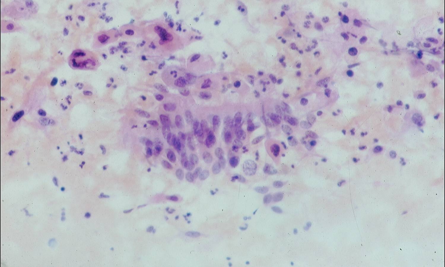 Eurocytology