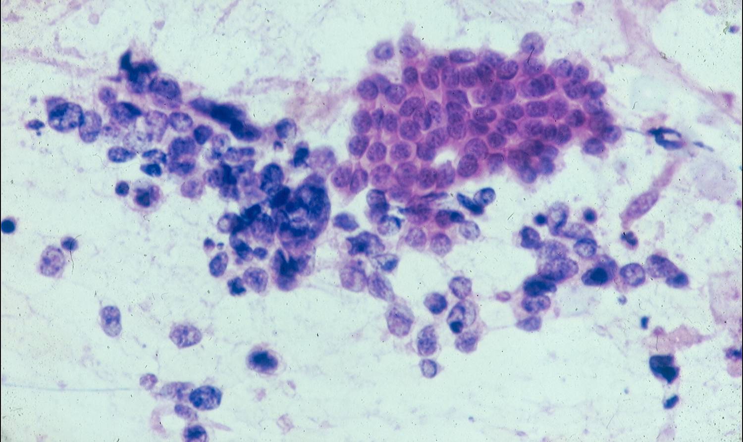 Eurocytology