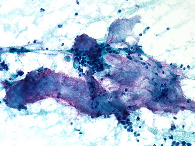 Eurocytology