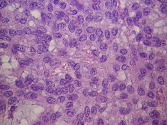 Eurocytology