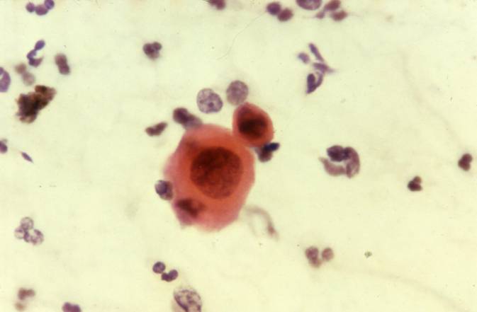 Eurocytology